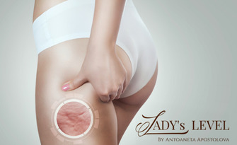 За перфектна фигура: Антицелулитен масаж с мед и вендузи, от Lady's Level Body Care Studio