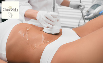 Кавитация, RF лифтинг и Vacuum масаж на цяло тяло или зона по избор, от Glow Skin Studio