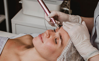 Лазерно премахване на микроблейдинг, перманентен грим или татуировка, от Beauty Secrets