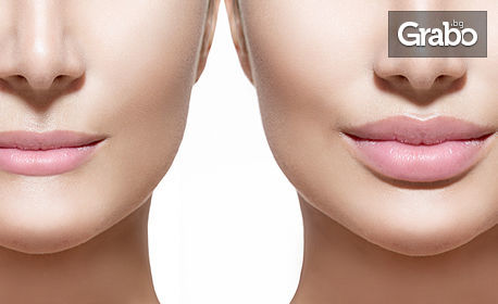Безиглено влагане на филър и маска с хиалуронова киселина - за уголемяване на устни или запълване на бръчки