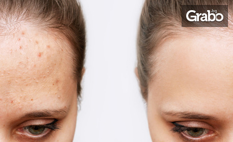 Свежест за всяка кожа: Терапия за лице с продукти Collagena - срещу акне, депигментираща или антиейдж