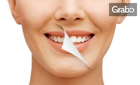 Избелване на зъби с Whiteness HP Mахх, плюс преглед и почистване на зъбен камък