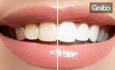 За искряща усмивка: Клинично избелване на зъби, плюс почистване на зъбен камък