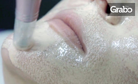 1 или 3 процедури микроиглена мезотерапия на лице и шия с Derma Pen - срещу белези, акне и отпусната кожа