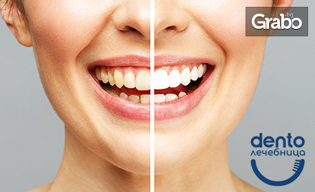 Кабинетно избелване на зъби с швейцарската система Pure, плюс почистване на зъбен камък, премахване на налепи и оцветявания, полиране и преглед