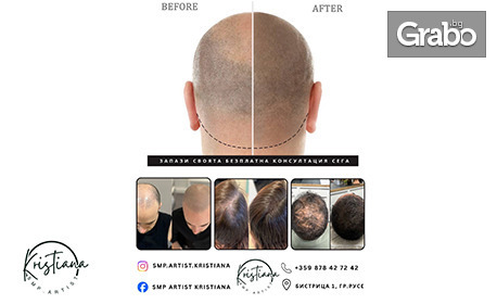 Върнете увереността и самочувствието си! Професионална микропигментация на скалп за мъже и жени