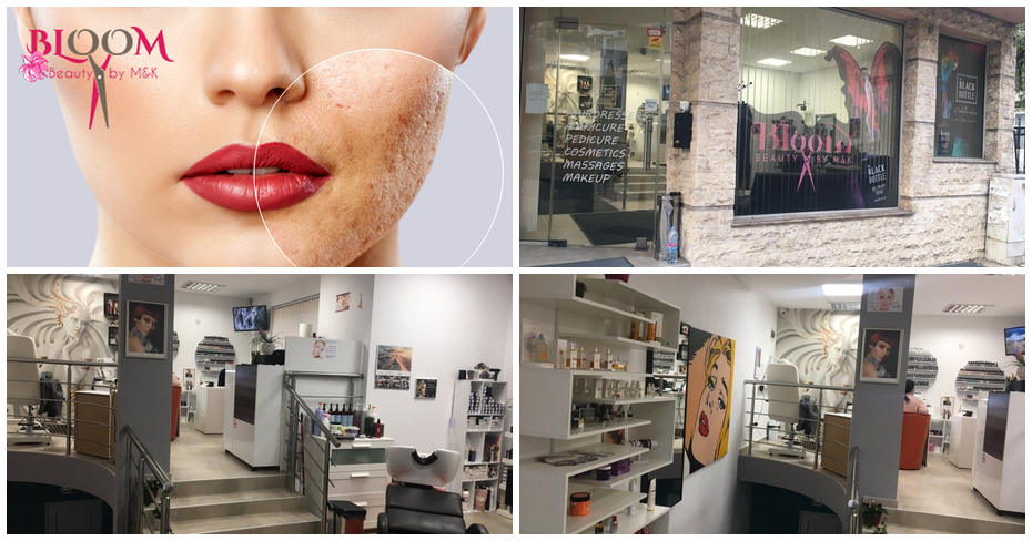 Карбонов пилинг на лице, от Bloom Beauty by M&K Карбонов пилинг на лице, от Bloom Beauty by M&K